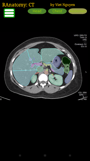 Radiology CT Anatomy para PC