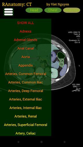 Radiology CT Anatomy para PC