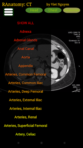 Radiology CT Anatomy PC