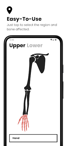 komputer Fractures