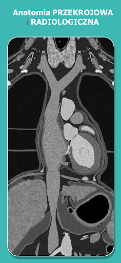 Anatomy Learning - Anatomia 3D