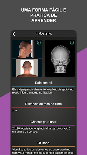 RX - Radiologia Posicionamento