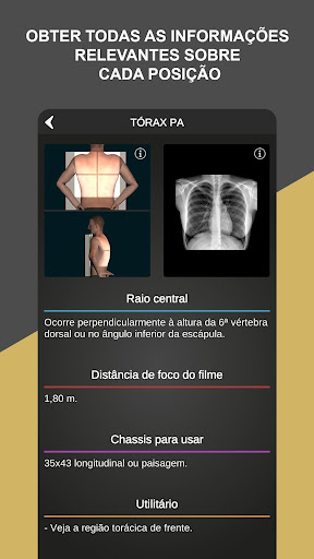 RX - Radiologia Posicionamento