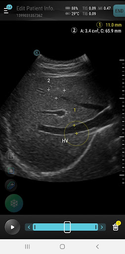 Aco Apache App電腦版