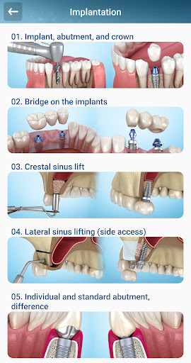 Dental 3D Illustrations PC