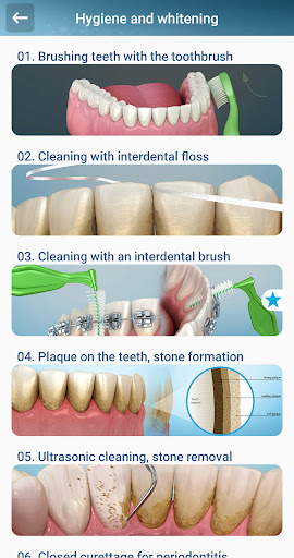 Dental 3D Illustrations PC