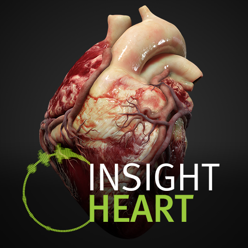 INSIGHT HEART الحاسوب