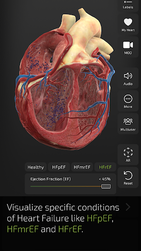 INSIGHT HEART PC版