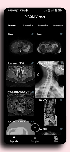 komputer DICOM Viewer