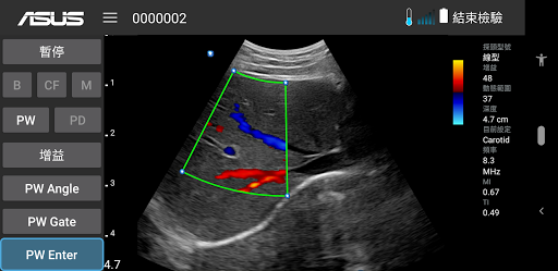 MediConnect – ASUS Ultrasound