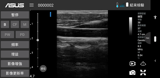 MediConnect – ASUS Ultrasound