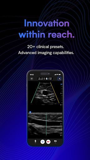 Butterfly iQ — Ultrasound para PC