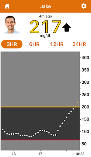 Dexcom Follow mg/dL DXCM3 PC