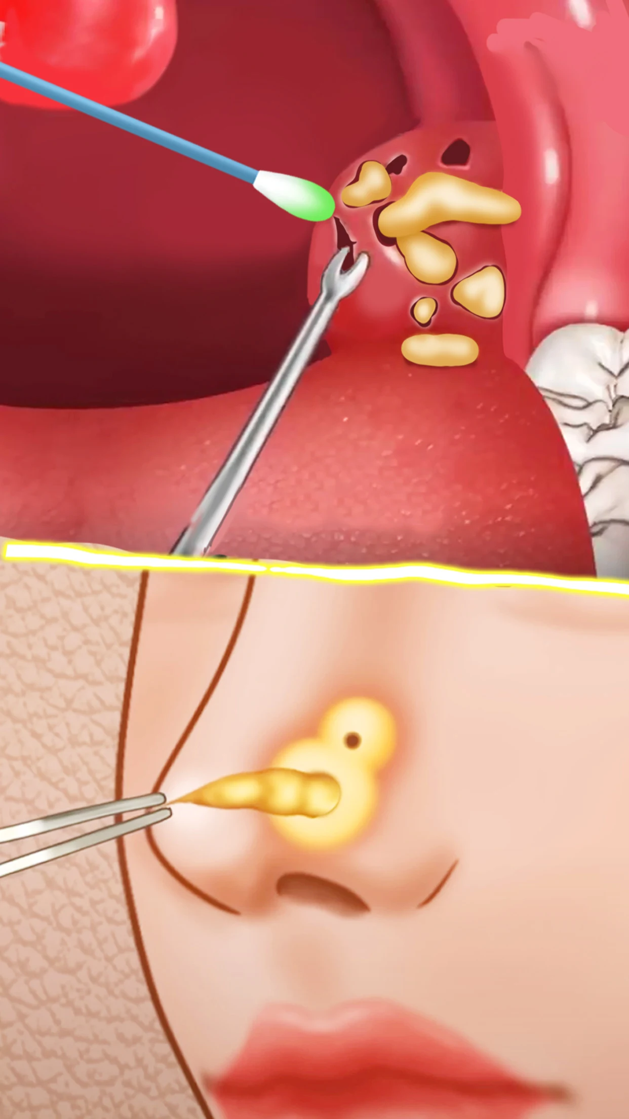 Happy Hospital: Doctor ASMR電腦版