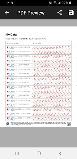 Pulse Oximeter - Beat & Oxygen PC