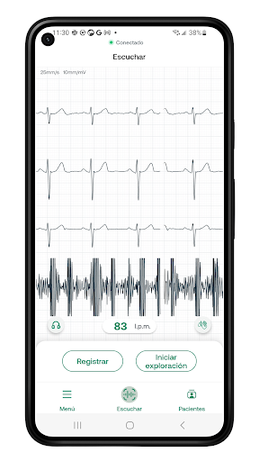 Eko: fonendoscopios digitales