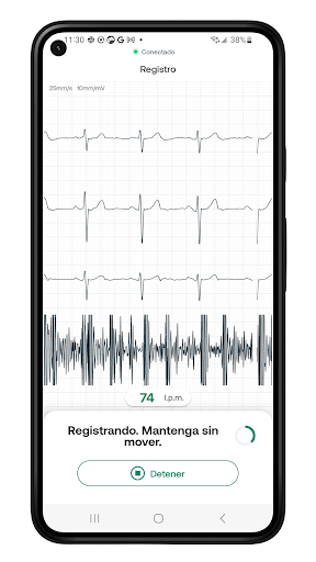 Eko: fonendoscopios digitales