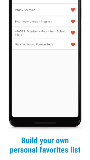 The POCUS Atlas para PC