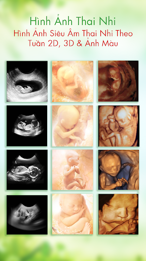 Cẩm Nang Bà Bầu PC