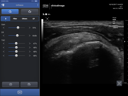 SONON Ultrasound App para PC