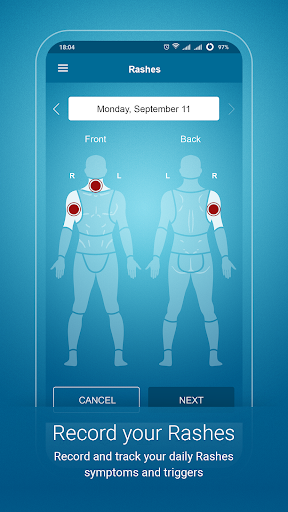 Psoriasis Monitor পিসি