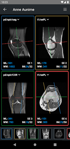 IDV - IMAIOS DICOM Viewer ПК