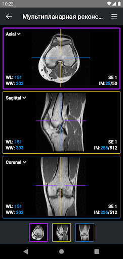 IDV - IMAIOS DICOM Viewer ПК