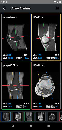 IDV - IMAIOS DICOM Viewer电脑版