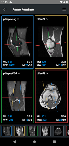 IDV - IMAIOS DICOM Viewer PC版