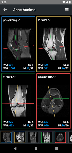 IDV - IMAIOS DICOM Viewer PC