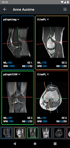 IDV - IMAIOS DICOM Viewer PC