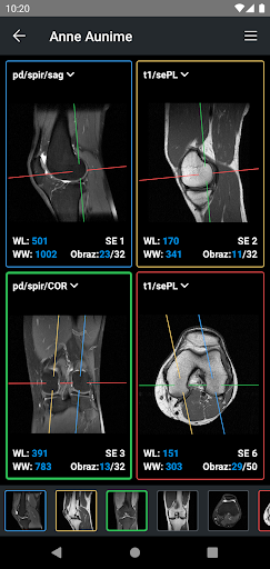 IDV - IMAIOS DICOM Viewer PC