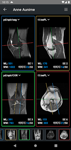 IDV - IMAIOS DICOM Viewer PC