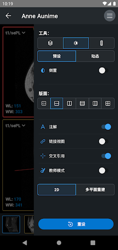 IDV - IMAIOS DICOM Viewer电脑版