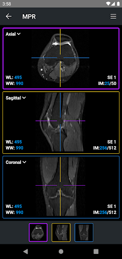 IDV - IMAIOS DICOM Viewer電腦版