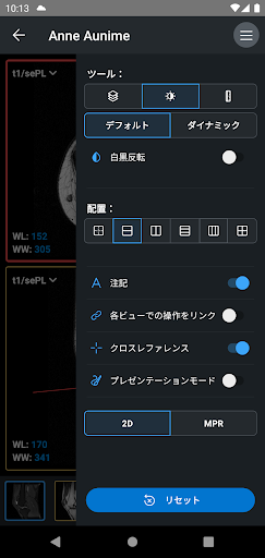 IDV - IMAIOS DICOM Viewer PC版