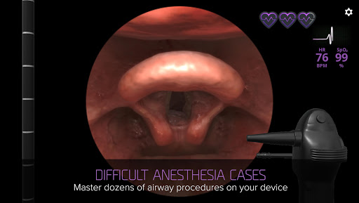 Airway Ex: Anesthesiology Game الحاسوب