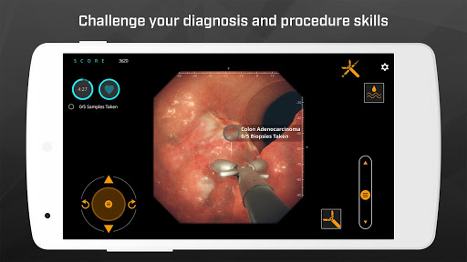 Gastro Ex: Played by Gastroent