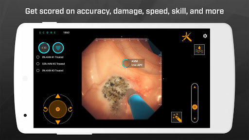 Gastro Ex: Played by Gastroent