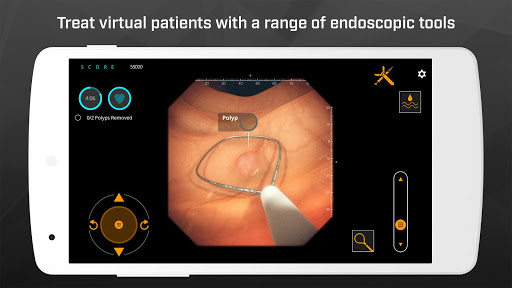 Gastro Ex: Played by Gastroent