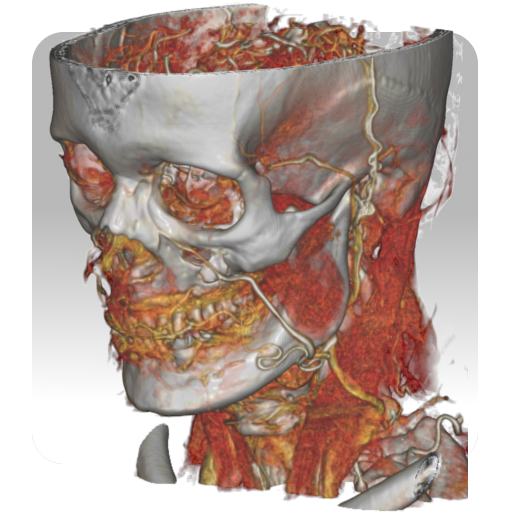 DroidRender - 3D DICOM viewer PC