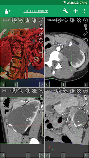 DroidRender - 3D DICOM viewer PC