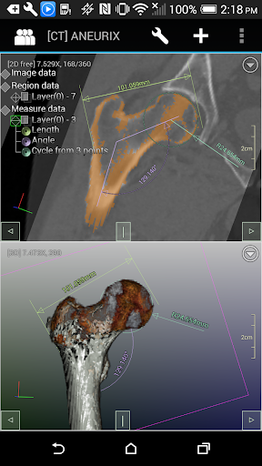 DroidRender - 3D DICOM viewer PC