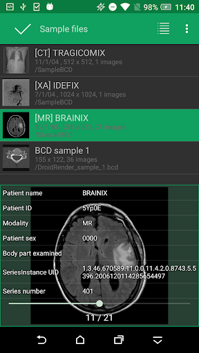 DroidRender - 3D DICOM viewer PC
