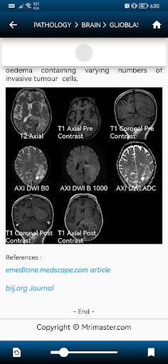 MRI MASTER PC