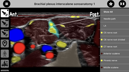 AnSo Anaesthesia Sonoanatomy الحاسوب