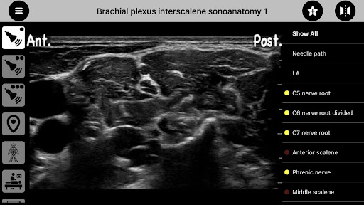 AnSo Anaesthesia Sonoanatomy الحاسوب