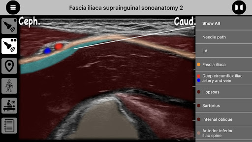 AnSo Anaesthesia Sonoanatomy الحاسوب