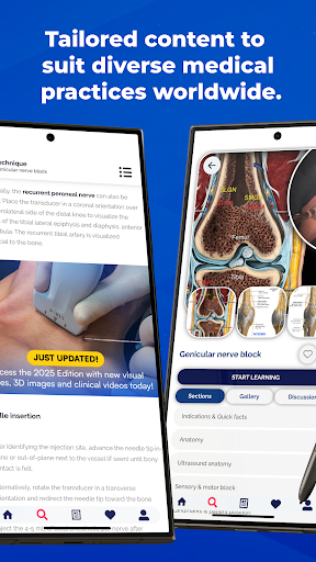 NYSORA Nerve Blocks PC
