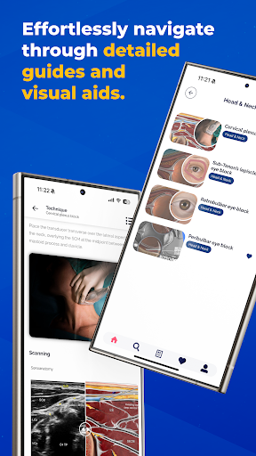 NYSORA Nerve Blocks PC